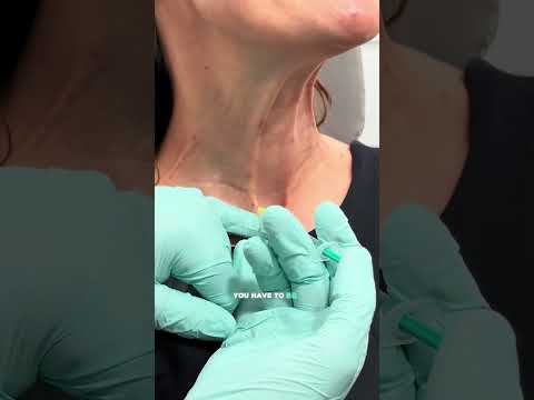 Botox For Your Neck Plasmid Bands?  #botoxinjections #antiaging #necktreatment