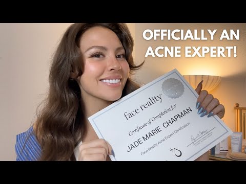 I'm Officially an ACNE EXPERT! | Jadeywadey180