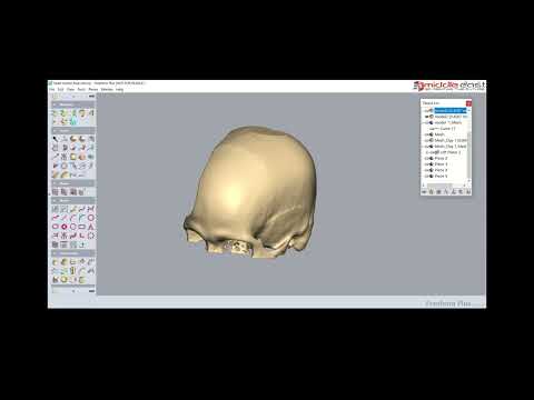 Cranial plate - Medical