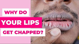 7 Causes Of Chapped Lips (Know to prevent)