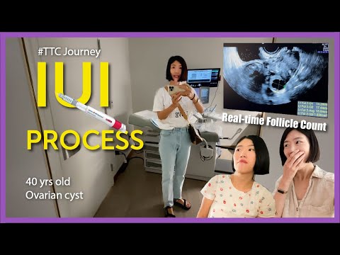 IUI with Gonal F injections - I documented my IUI  journey and shared tips & info #ttcjourney at 40