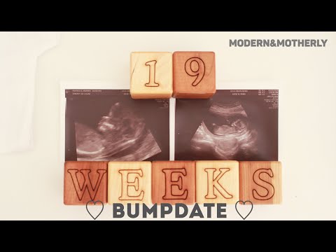 High Risk Pregnancy Update | 4 Months Pregnant | 16-19 Week Bumpdate - Baby #2