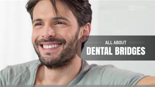 Storytelling: All About Dental Bridges | GMedia Dallas Dental Marketing & Web Design