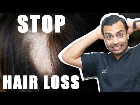 Hair Loss Distress: How to Manage and Overcome - Doctor Reveal the Truth and Solutions!