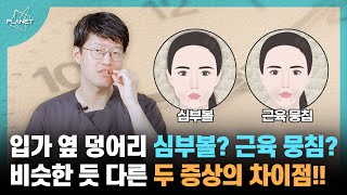 심부볼과 근육 뭉침으로 인한 심술궂은 표정...원인에 따라 치료 방법도 다릅니다!!