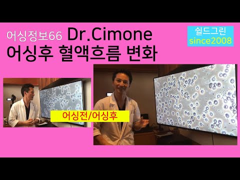 어싱정보66-어싱효과 핵심! 어싱 당신의 혈액순환을 도와줍니다-Cimone박사 실험