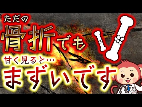 【注意】ただの手指の骨折と軽んじないでください。【現役整形外科医が監修】