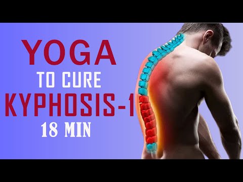 How to fix kyphosis through yoga, Yoga for hunchback, Yoga practice for hunchback, Yoga for Kyphosis