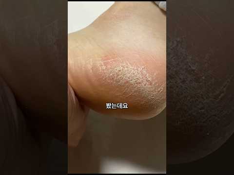 와이프 발에 뽀뽀 가능? 발뒤꿈치 각질 제거 : 도도풋케어 #내돈내산 #제품리뷰