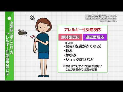 2021年8月14日放送　夏に注意すべき皮膚の病気①「虫刺症（虫さされ）」　ひつじがおか皮フ科クリニック