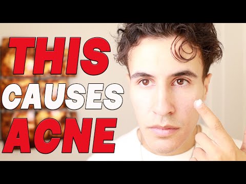 Things You Do Every Day That Can Cause Acne