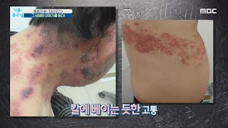 [기분 좋은 날] 통증의 왕 ＜대상포진＞ 그 생생한 이야기를 듣다! MBC 201012 방송