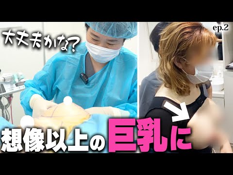 これが2回目豊胸の存在感！全身脂肪吸引で40代奇跡のボディチェンジ！ep2｜美ボディラインch#224