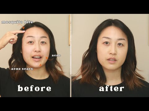 How To Conceal Blemishes | Acne Scars, Bug Bites, & Pimples