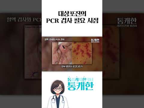 이럴때는 반드시 대상포진 검사(PCR) 해보셔야 합니다.