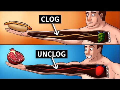 9 Foods that Clog & Unclog Arteries