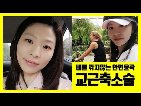 사각턱 턱근육..안면윤곽을 한다면? 교근축소술로 V라인추천