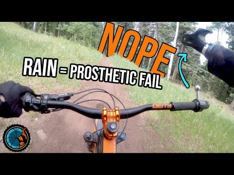 The Day My Prosthetic Failed - Mountain Biking Angel Fire Bike Park and South Boundary Trail