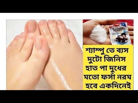 ফাটা গোড়ালি হাত পা দুধের মতো ফর্সা নরম হবে/কালো ময়লা উঠে যাবে/Feet hand Whiteninge/Crackedheel treat