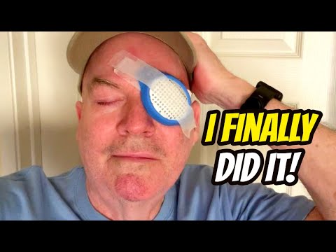 My CATARACT SURGERY Experience