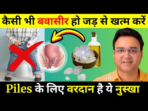 बवासीर (Piles) के मस्सो को कुछ ही दिन में सुखा देगा ये आसान घरेलु इलाज | Piles Treatment At Home