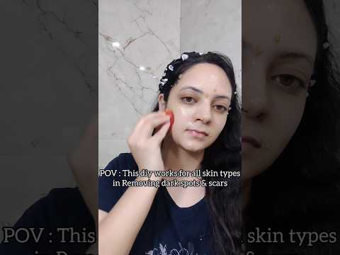 Face mask for removing dark spots #skincare #darkspots #trending #viral #ytshorts #shorts #shorts