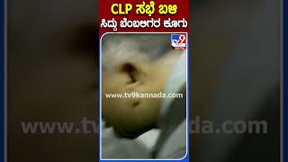 CLP Meeting ಹೋಟೆಲ್ ಮುಂದೆ ಸಿದ್ದು fans ಘೋಷಣೆ | #TV9S