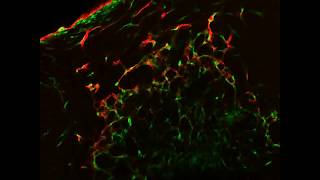 Inside a Vascular Organoid