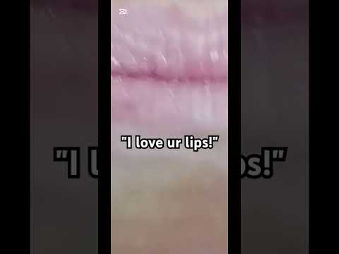 Lips?