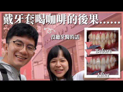 戴完隱適美牙齒變超黃⋯⋯連老婆都看不下去｜豬豬隊友 Scott & Wendy