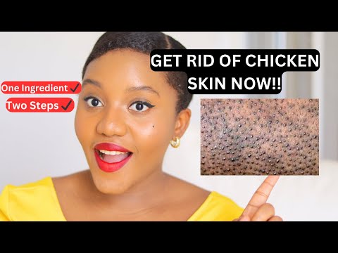 HOW TO GET SILKY SMOOTH SKIN | GET RID OF STRAWBERRY SKIN, CHICKEN SKIN | KERATOSIS PILARIS