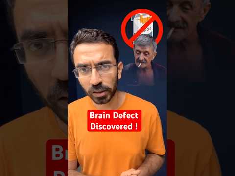 Big  Brain Defect Affecting our Lives.