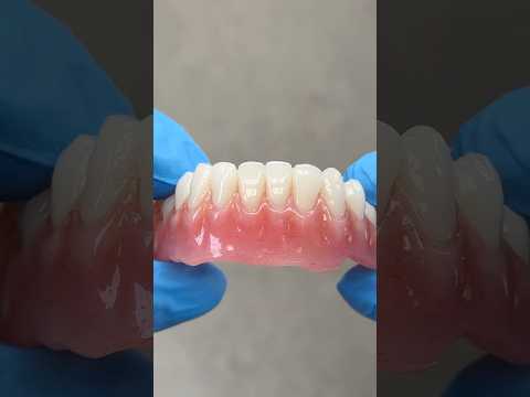 Mandibular Process Denture #lsk121shorts #dentist #teeth