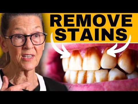 How to remove stains on teeth at-home