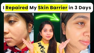 How I Repaired My Skin Barrier in 3 days at Home with Minimal Skincare Products!