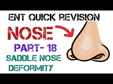 Saddle Nose Deformity: Causes and Treatments | DNS vs Septoplasty by Dr. Deen