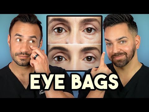 How Treat Under Eye Bags Like A Dermatologist