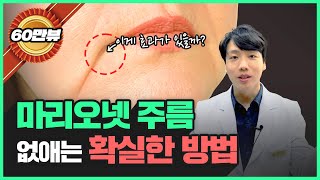 마리오네트 주름 확실한 예방법!! | 입꼬리 처짐, 심술보, 불독살