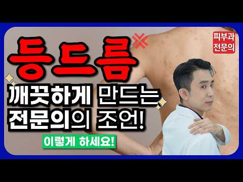 등드름과 가드름을 없애는 가장 확실한 방법! - 연고, 압출부터 예방까지 전부다 알려드립니다!