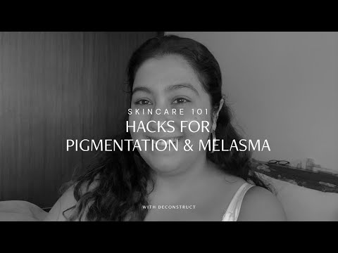 Hacks for Pigmentation, Melasma and a Healthy skin!!