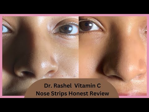 DR.Rashel Nose Pore Strips Honest ( Live Review) || How to remove blackheads & white heads