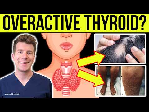 SKIN, NAIL, AND HAIR SIGNS associated with an OVERACTIVE THYROID (Hyperthyroidism)