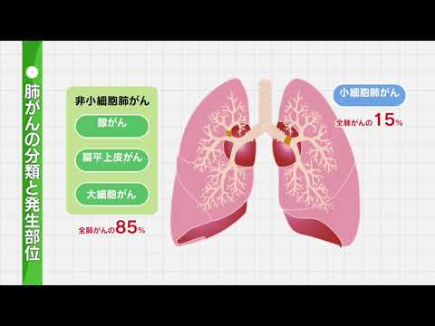 20241130　正しく理解しよう｢肺がん｣