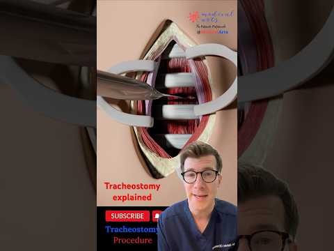 Doctor explains tracheostomy #shorts