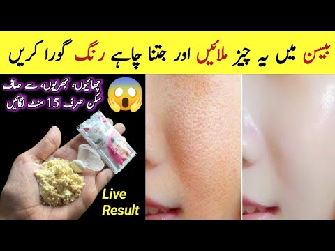 Best Skin Whitening Home Remedy | Suntan Removal Home Remedy | Glowing Skin