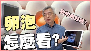 【幸孕小角落】醫師照的卵泡怎麼看? 我的卵子是好的嗎?｜台中大新婦產科診所 生殖中心