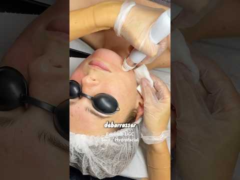 Exemple UGC Hydrofacial #creatriceugc #ugc #ugcexample #ugchydrofacial #soinsduvisage