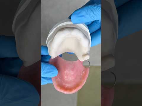 Clasping to the last tooth #lsk121shorts #dentist #teeth