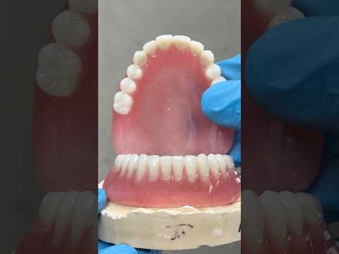 Process Hybrid Locator Dentures #lsk121shorts #dentist #teeth