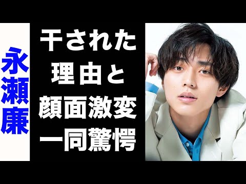 【驚愕】永瀬廉が業界から干された3つの理由がヤバい...！平野紫耀が暴露した彼の裏の顔や、顔面激変の真相に驚きを隠せない...！